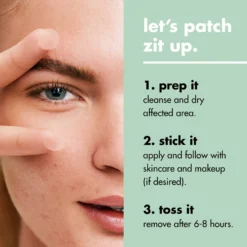 Blemish Breakthrough Stick It to Zits Pimple Patches