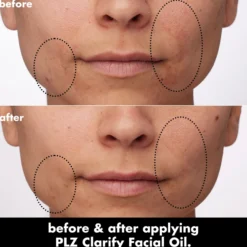 PLZ Clarify Facial Oil