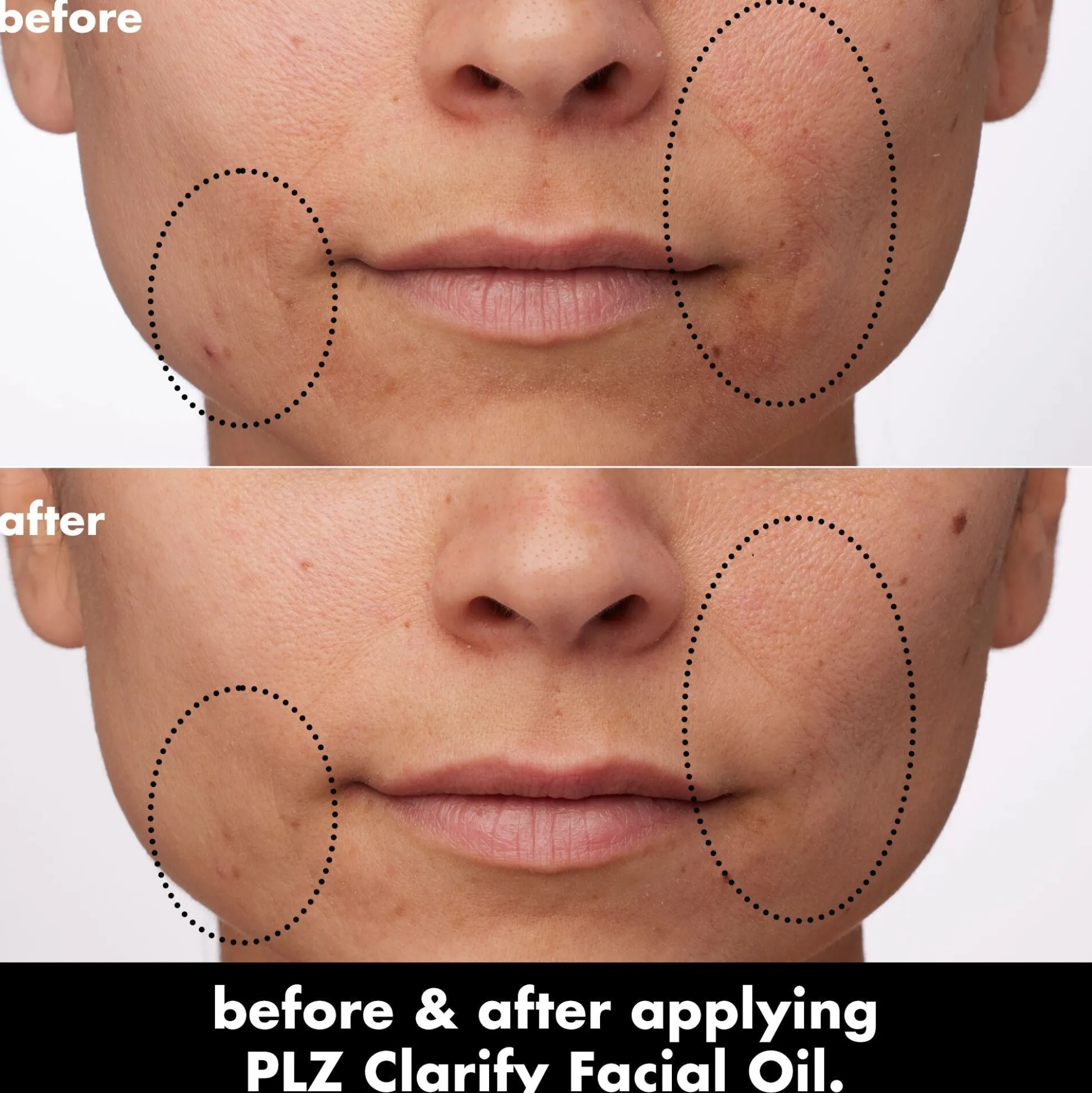 PLZ Clarify Facial Oil