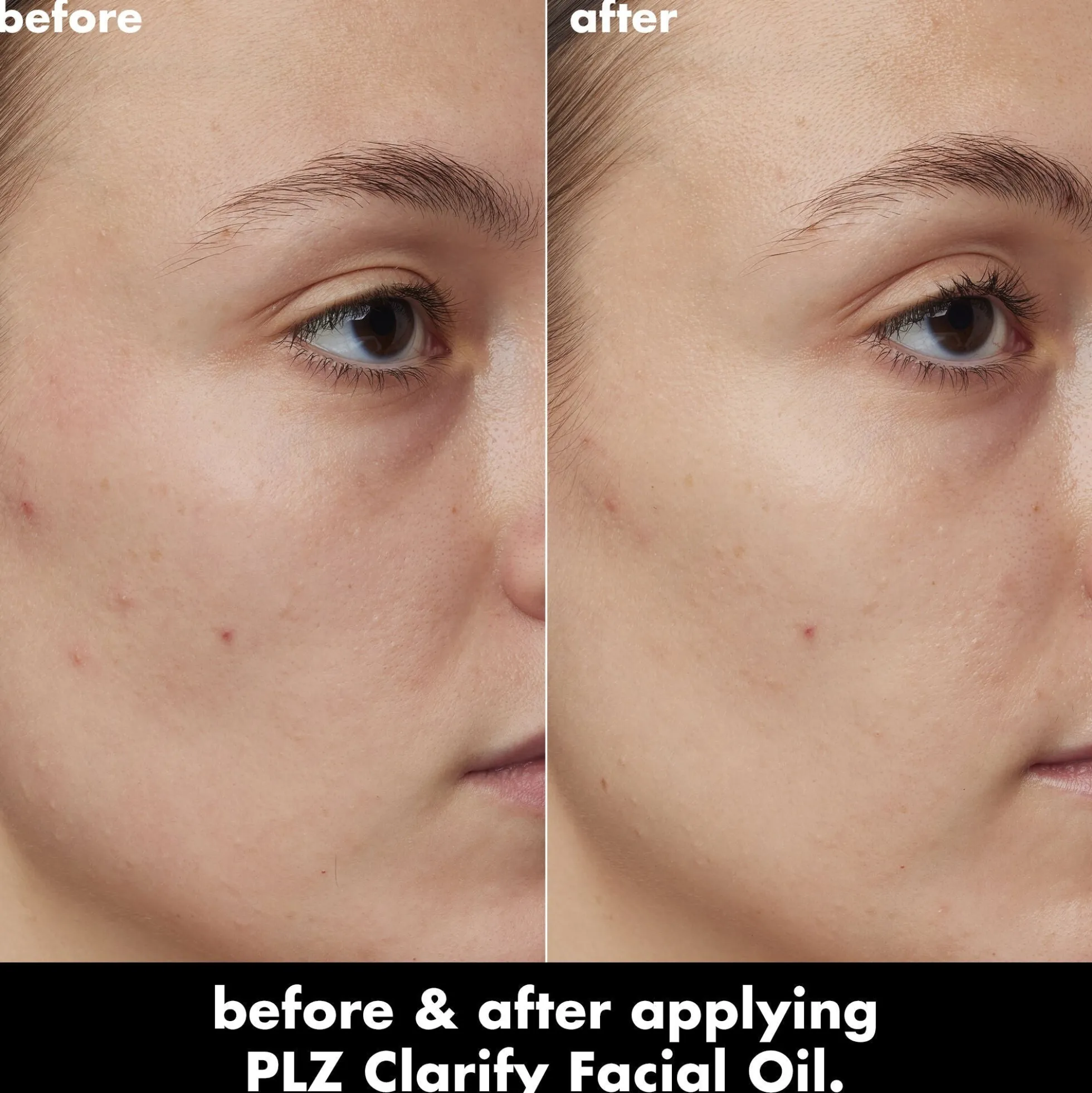 PLZ Clarify Facial Oil
