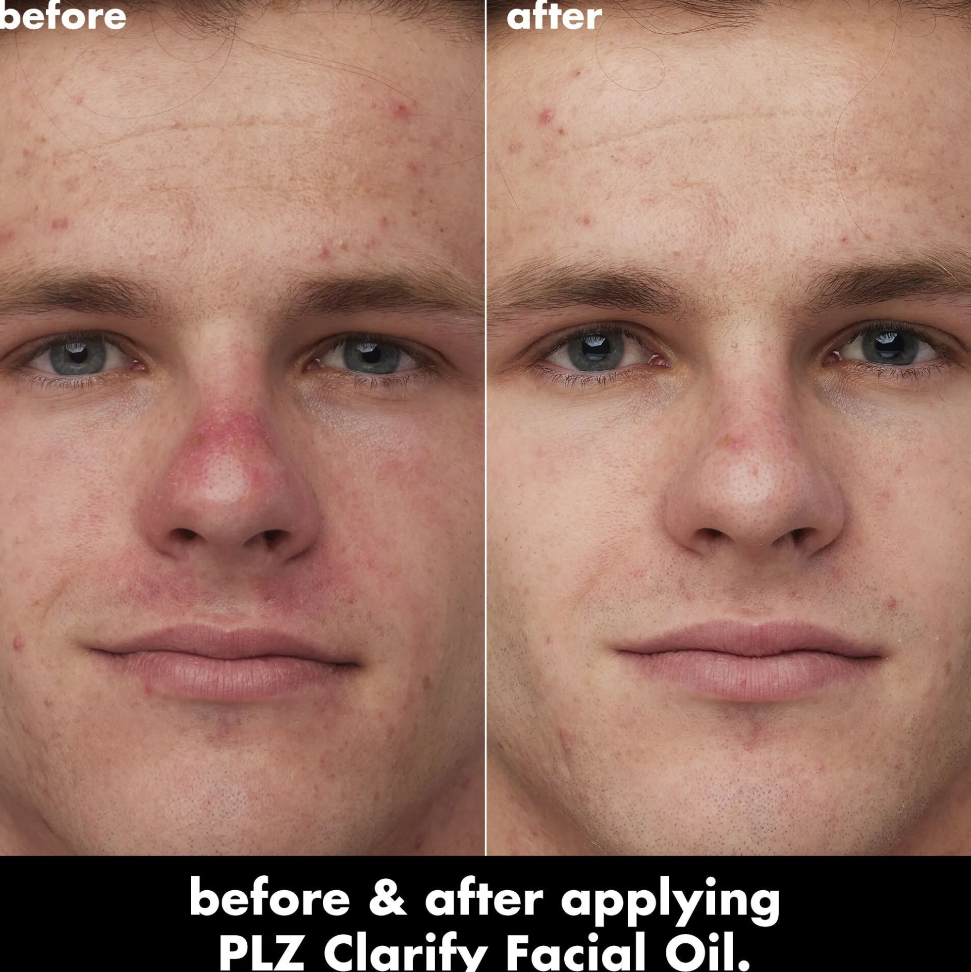 PLZ Clarify Facial Oil
