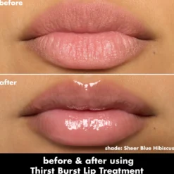 Thirst Burst Lip Treatment